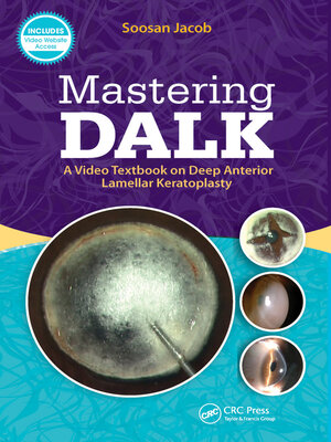 cover image of Mastering DALK